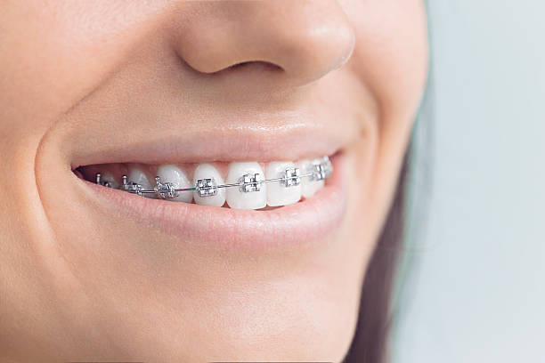 Best Dentures (Full and Partial)  in West, TX